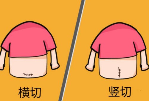孕中期胎停的原因有哪些，胎停多半和這三點(diǎn)有關(guān)