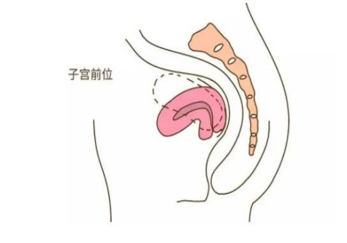 11號(hào)染色體倒位對(duì)胎兒的影響很大，附11號(hào)染色體倒位的癥狀